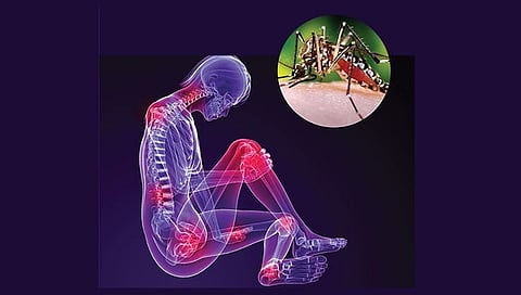 Viral fever chikungunya