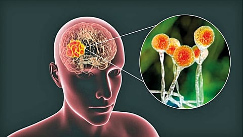 brain eating amoeba