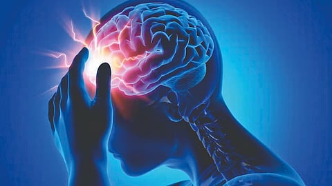 Migraine Causes