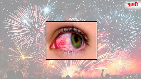 Diwali Firecrackers Eye Injuries