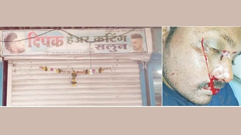 Razor attack crime