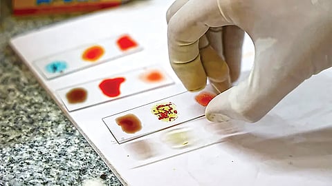 Rare Blood Group