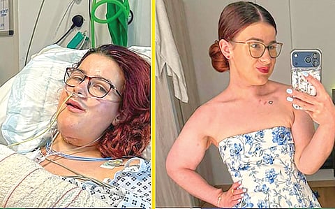 Cancer Surgery