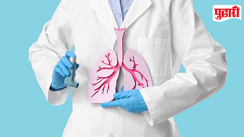 Tuberculosis