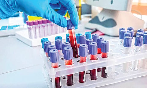 Prostate cancer treatment