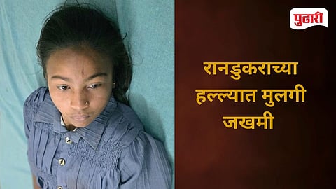 Girl Injured in Washim