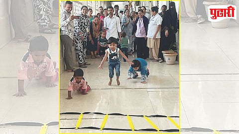 Clubfoot Treatment Success