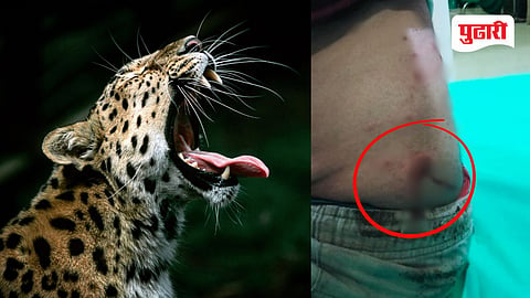 Leopard attack