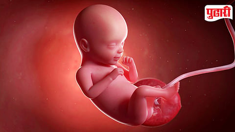 Abortion