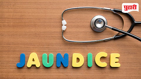 Newborn Jaundice Test