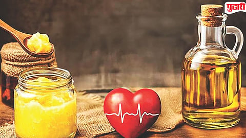 Refined Oil Health Tips