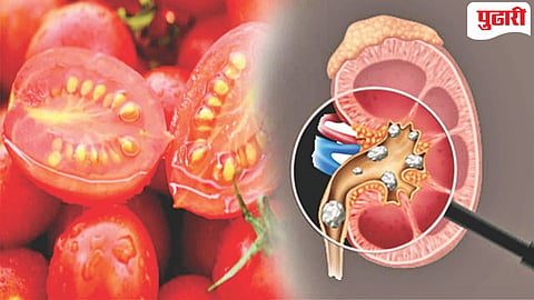 Tomato Myths