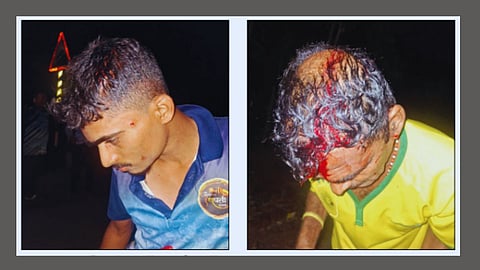 Ratnagiri Leopard Attack