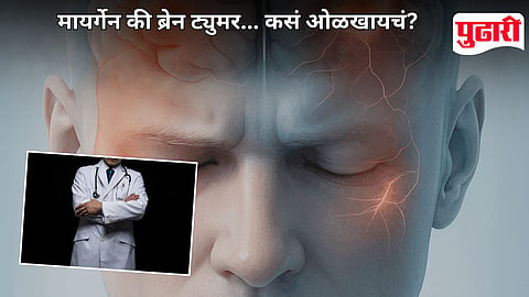 Migraine Vs Brain Tumor