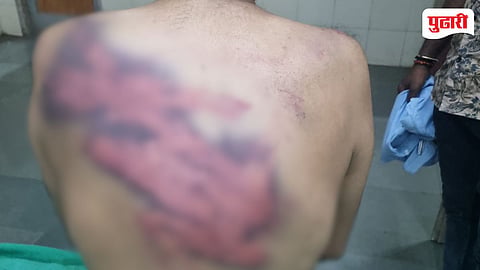 Beed Crime News : परळीत महिला महाविद्यालयातील कर्मचाऱ्यास घरातून घेऊन जाऊन अमानुष मारहाण