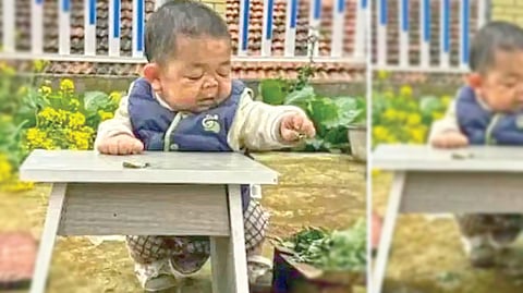 Rare Medical Condition |