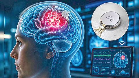 Brain Implant Device |