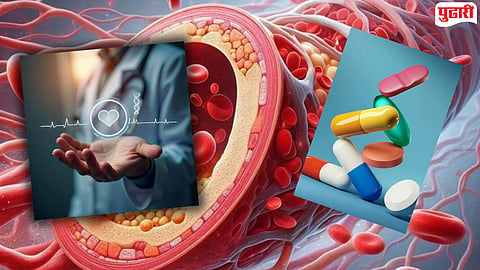 Cholesterol Medicine Safety
