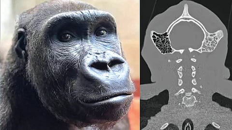 Gorilla skull surgery |