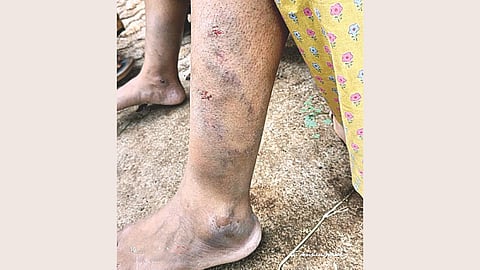 Satara Crime: मुख्याध्यापकाने शिक्षिकेला बदडले