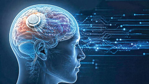 First Commercial Brain Chip |