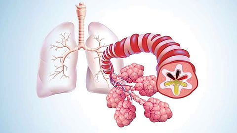 Popcorn Lung Disease |