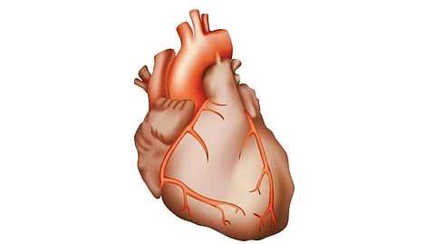 Bradycardia |