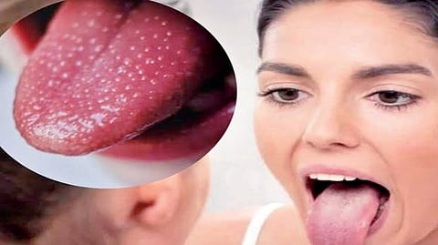 health Awareness |