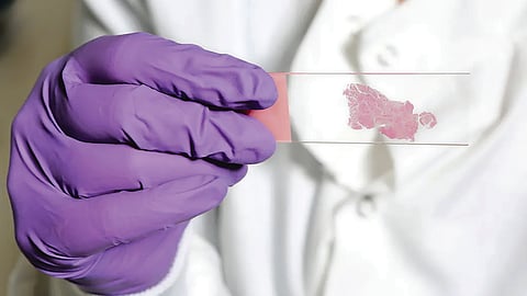 AI Pathology |