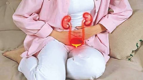 Bladder Irritation |
