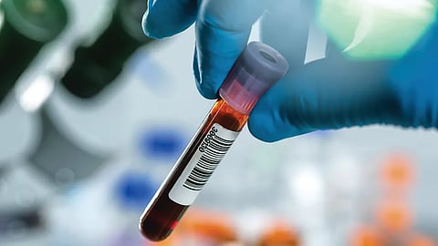 Blood Protein Signature |