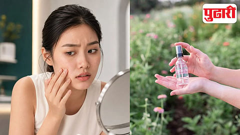 Winter Skincare Tips