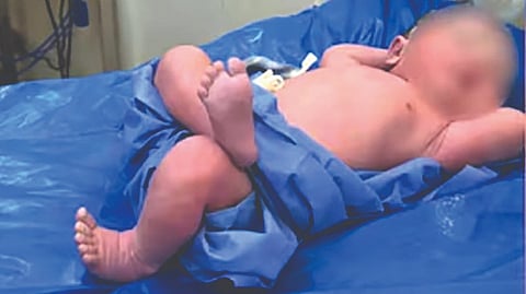Baby Sleeping Pose |
