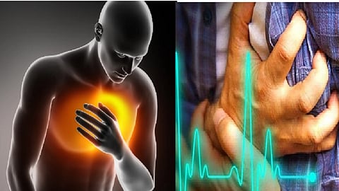 heart attack