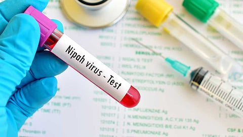 nipah virus