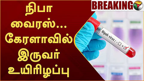 நிபா வைரஸ்