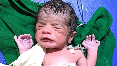 Miracle baby