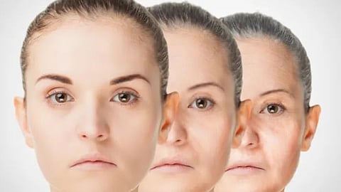de aging