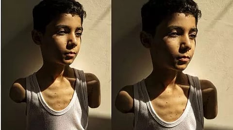lost both arms in an israeli palestinian boy from gaza wins world press photo award 2025