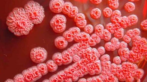 melioidosis