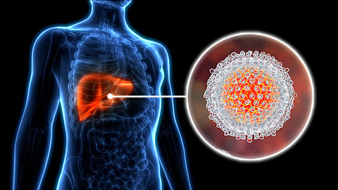 Bepirovirsen Treatment for Chronic Hepatitis B Virus Infection