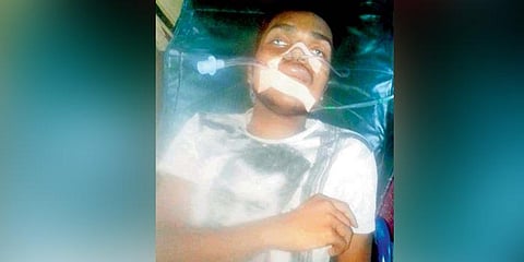 நல்ல பாம்புக்கு முத்தம்: வாலிபருக்கு ஜெயில்!