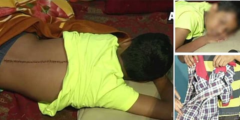 இருக்கை தகராறில் சகமாணவனை பிளேடால் கீறிய கொடூரம்