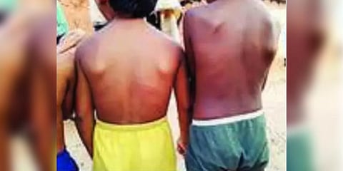 குடை வரைய தெரியாத மாணவர்களுக்கு அடி உதை - ஆசிரியை கணவர் ஆவேசம்