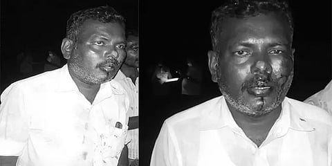 மேலூர்: அரசு மதுபானக் கடை ஊழியரிடம் 5 லட்சம் பணம் வழிப்பறி