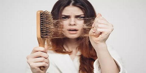 முடி கொட்டுதல் பிரச்னை தலைதூக்குகிறதா? இவற்றை செய்துபாருங்க!