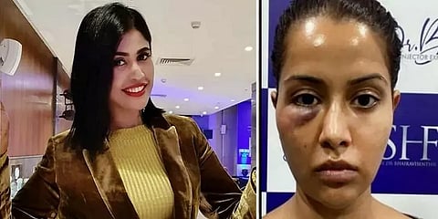 முகம் வீங்கிய விவகாரம்: ரூ.1 கோடி நஷ்ட ஈடு கேட்டு ரைசா நோட்டீஸ்!