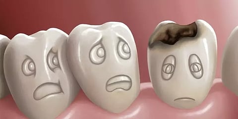 பல் சொத்தையா? - இதை கவனியுங்க