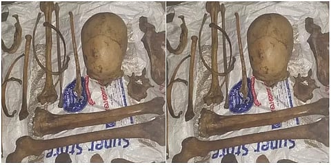 சென்னையில் குப்பை தொட்டி அருகே வீசப்பட்ட மனித எலும்பு கூடுகளால் பரபரப்பு