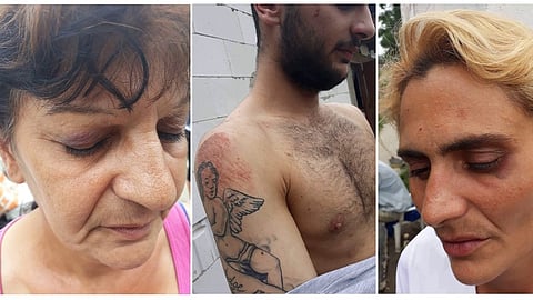 Úrad inšpekčnej služby MV už takmer rok vyšetruje či policajti zbili Rómov v Milhosti.